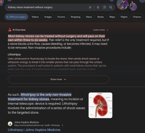 AI Overviews