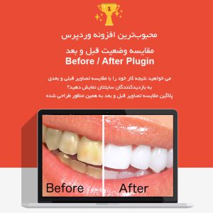 افزونه Before After Slider | مقایسه وضعیت قبل و بعد